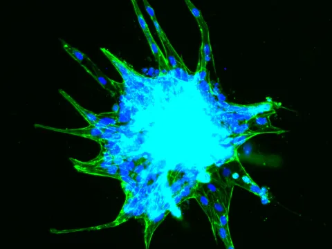 Fluorescent cell image.